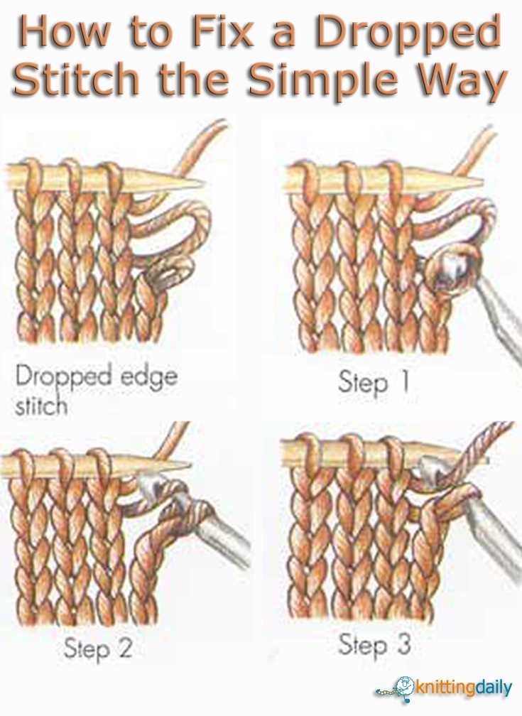 Importance of Stitches in Knitting